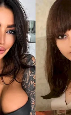 Alena Amovic vor plastischer Chirurgie