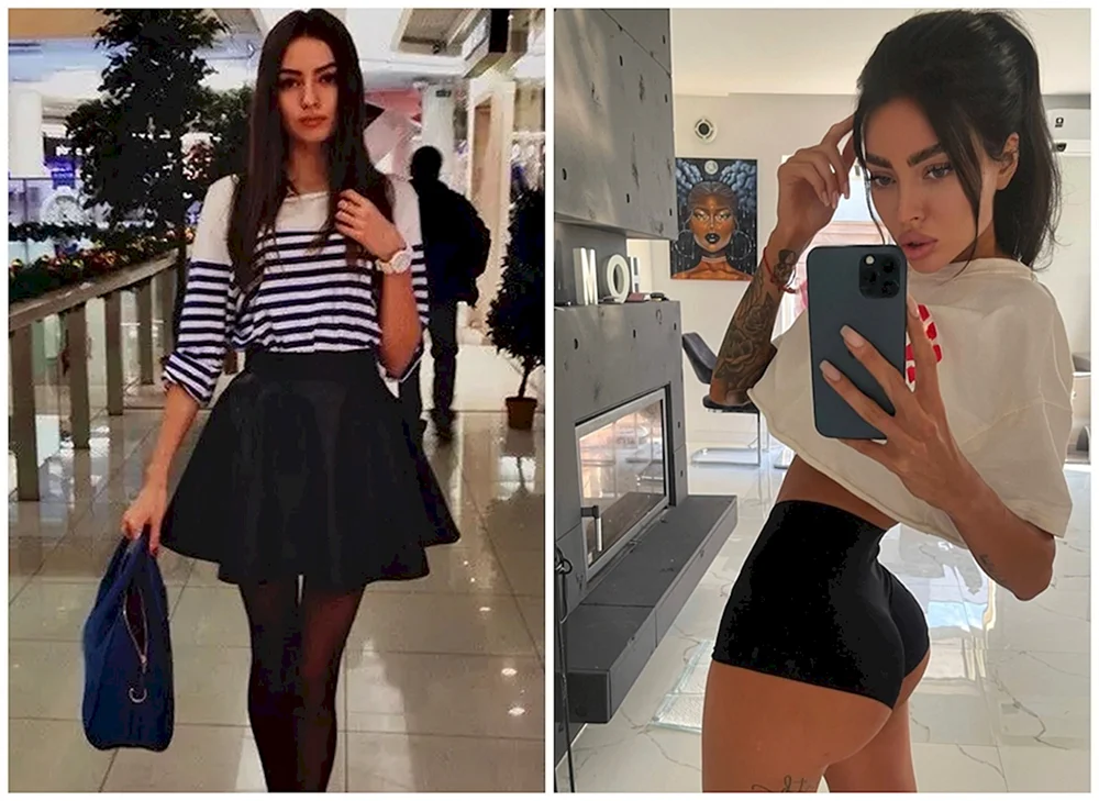 Alyona Shishkova vor plastischer Chirurgie