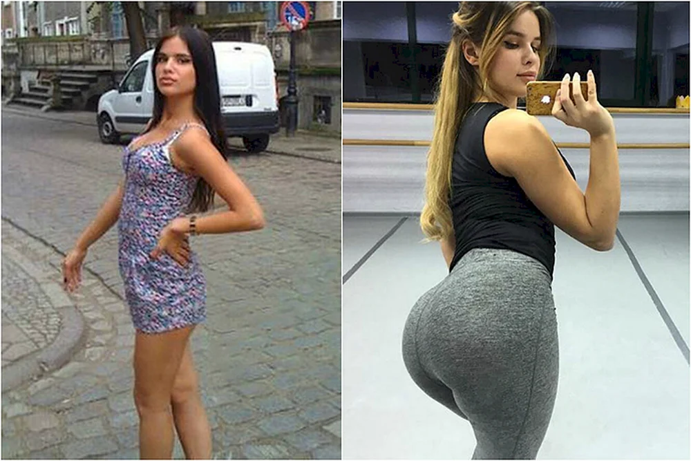 Anastasia Kvitko vor plastischer Chirurgie