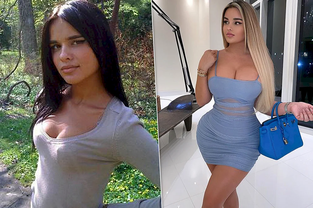 Anastasia Kvitko Vor Plastische Chirurgie in ihrer Jugend