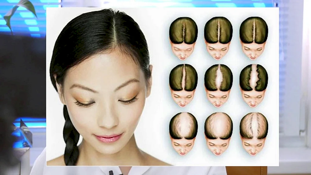 Haarwuchslinie