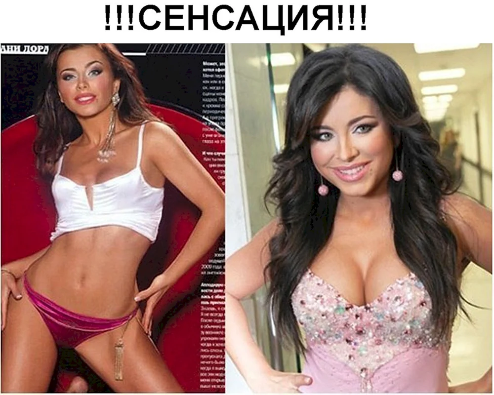 Ani Lorak vor Operation