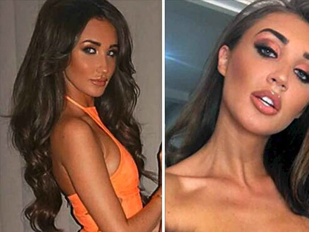 Anyuta Paradise vor plastischer Chirurgie