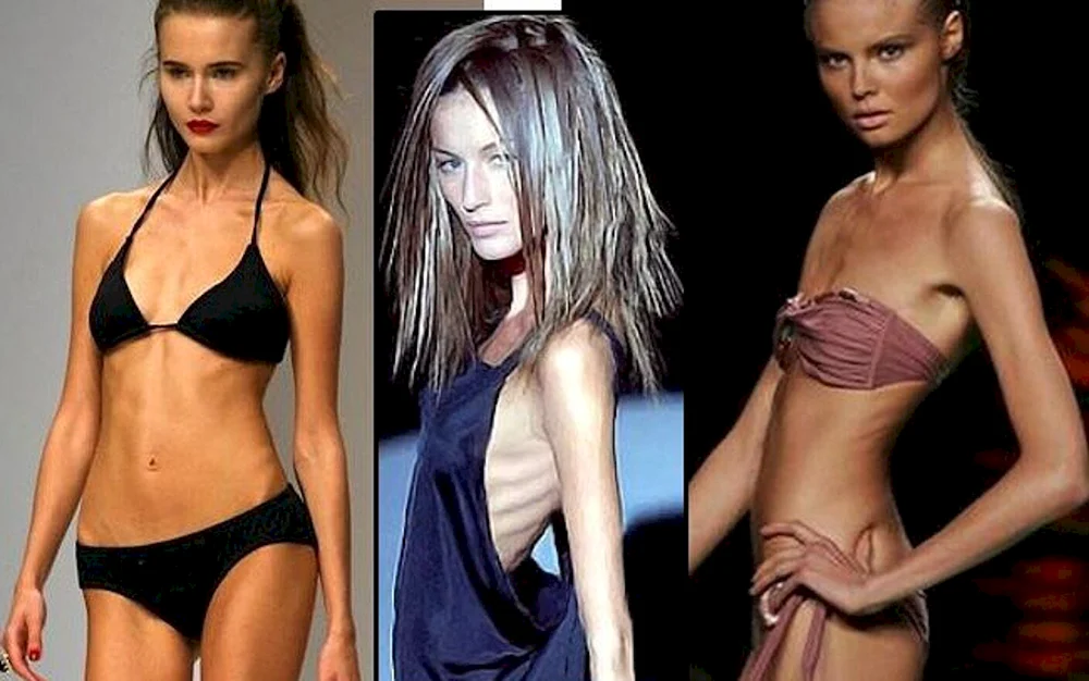 Anna Reston ist das dünnste Model