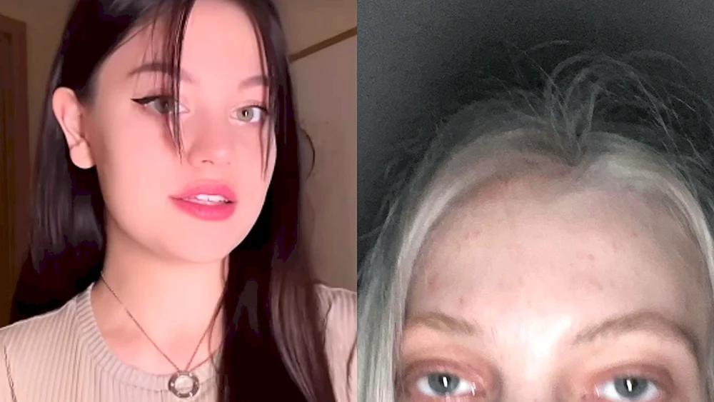 Yulia Finness telegrammiert