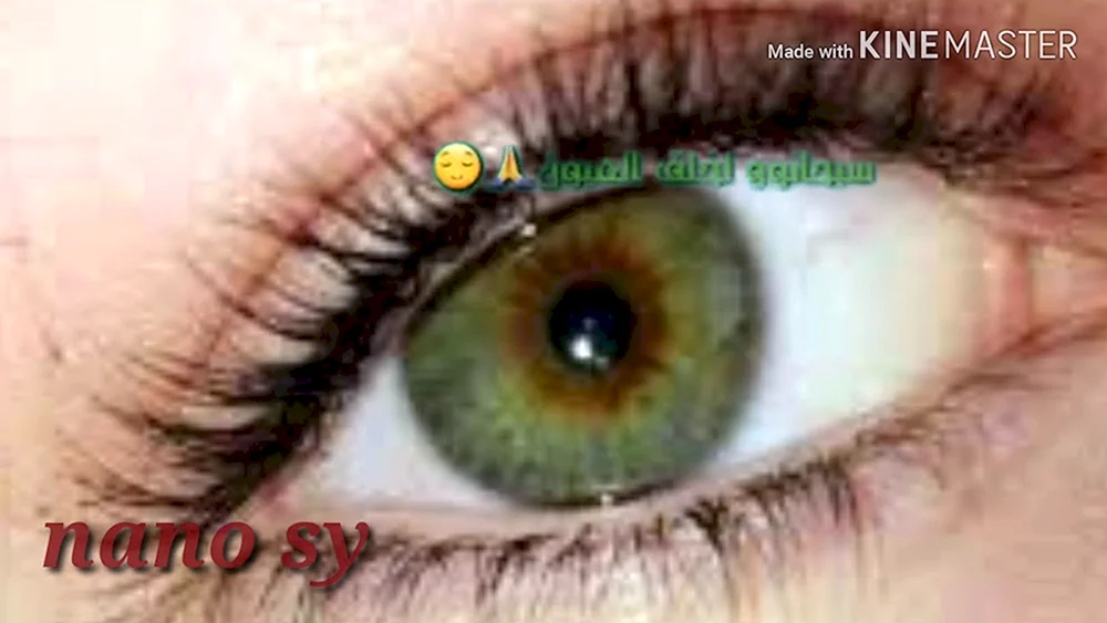 Sumpfaugenfarbe Heterochromie