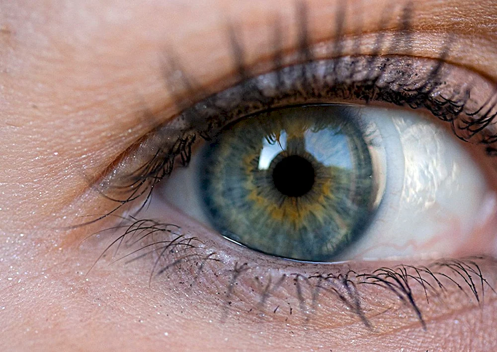Grüne Heterochromie Augenfarbe