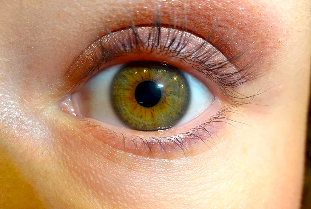 Marschgrüne Heterochromie Augenfarbe
