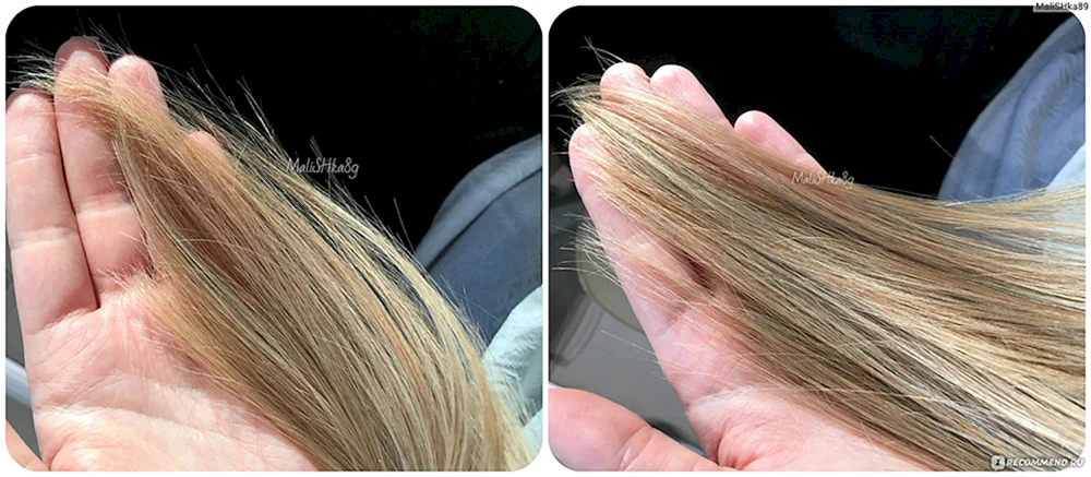 Botox für Haar