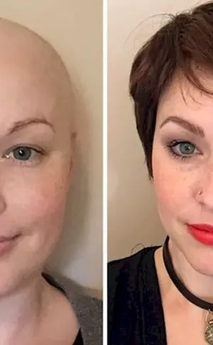 Augenbrauen nach Chemotherapie