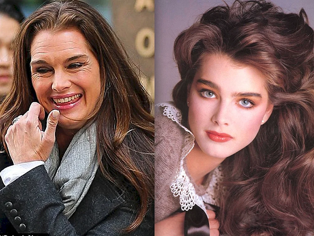 Brooke Shields als junge Frau 1975