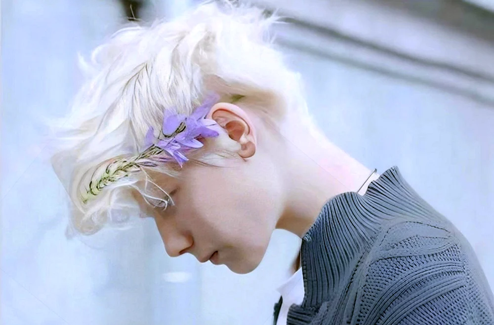Daniil Mileev albino