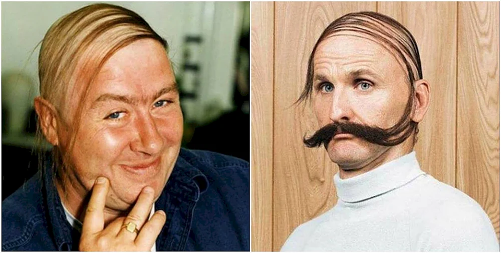Lange Haare mit Glatze