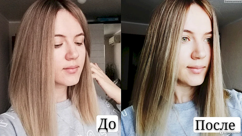 Allergien gegen Haarverlängerungen