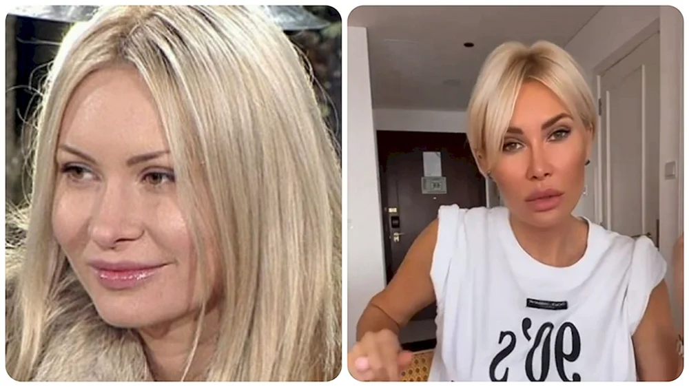 Elina Kamiren vor und nach der plastischen Chirurgie