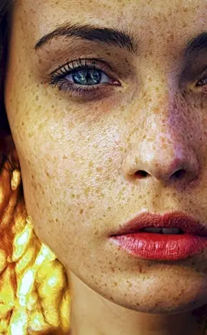 Emma Stone Sommersprossen