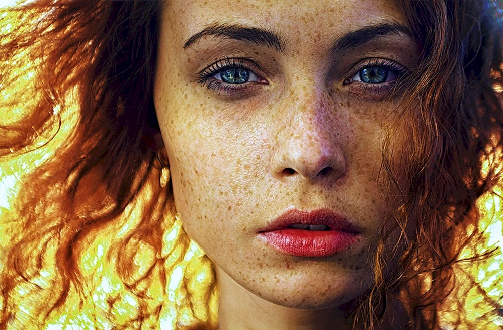 Emma Stone Sommersprossen