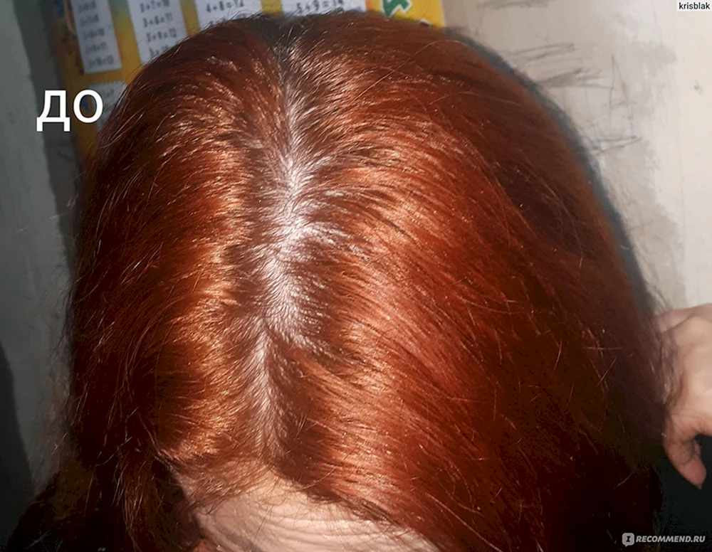 Estel 54 auf Haar