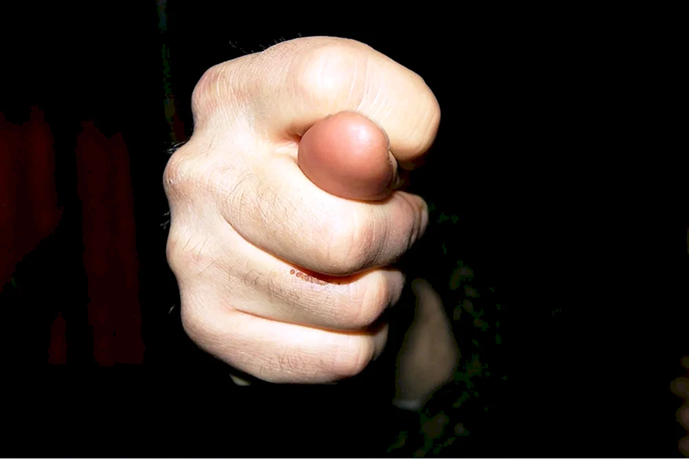 Finger Fig