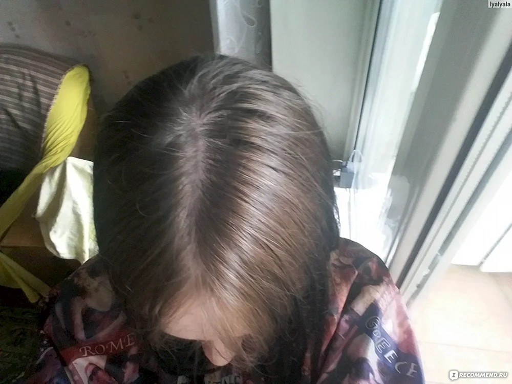 Loreal Farbguss Frosty Kastanie