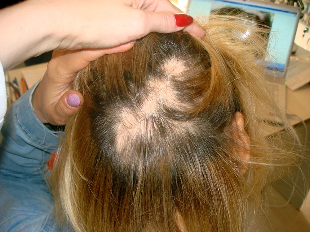 Leichtes Haar bei Frauen