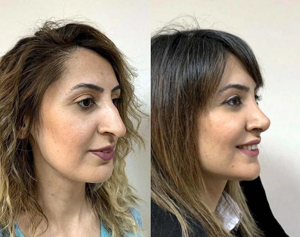 Goar Arzumanyan