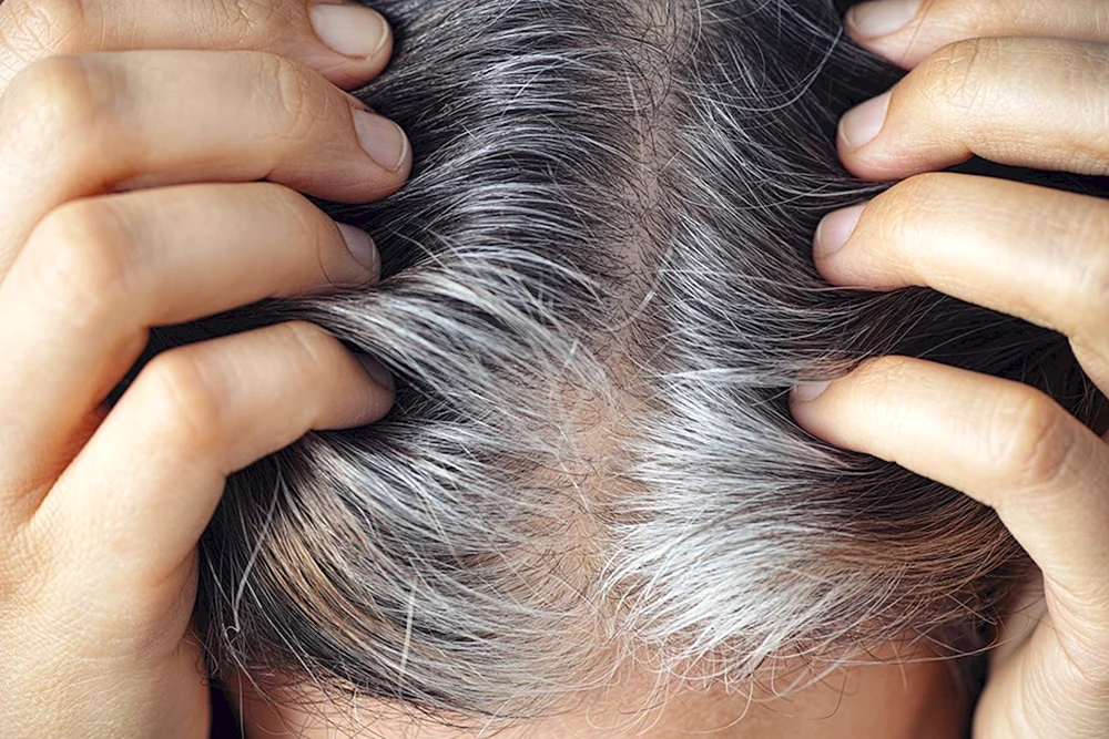 Graue Haare
