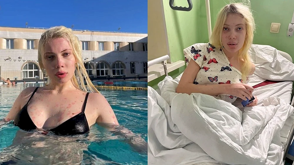 Yulia Finness gestorben