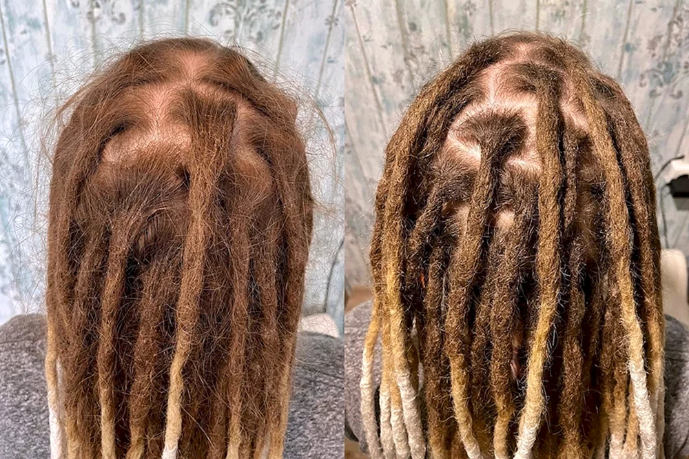 Dreadlocks flechten