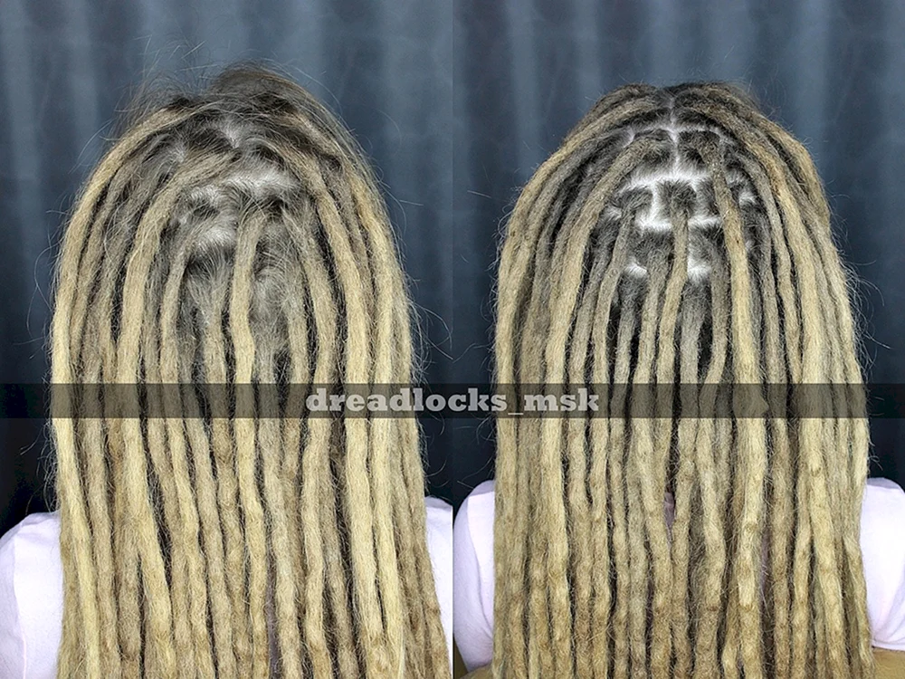 Dreadlocks vor und nach Dreadlocks