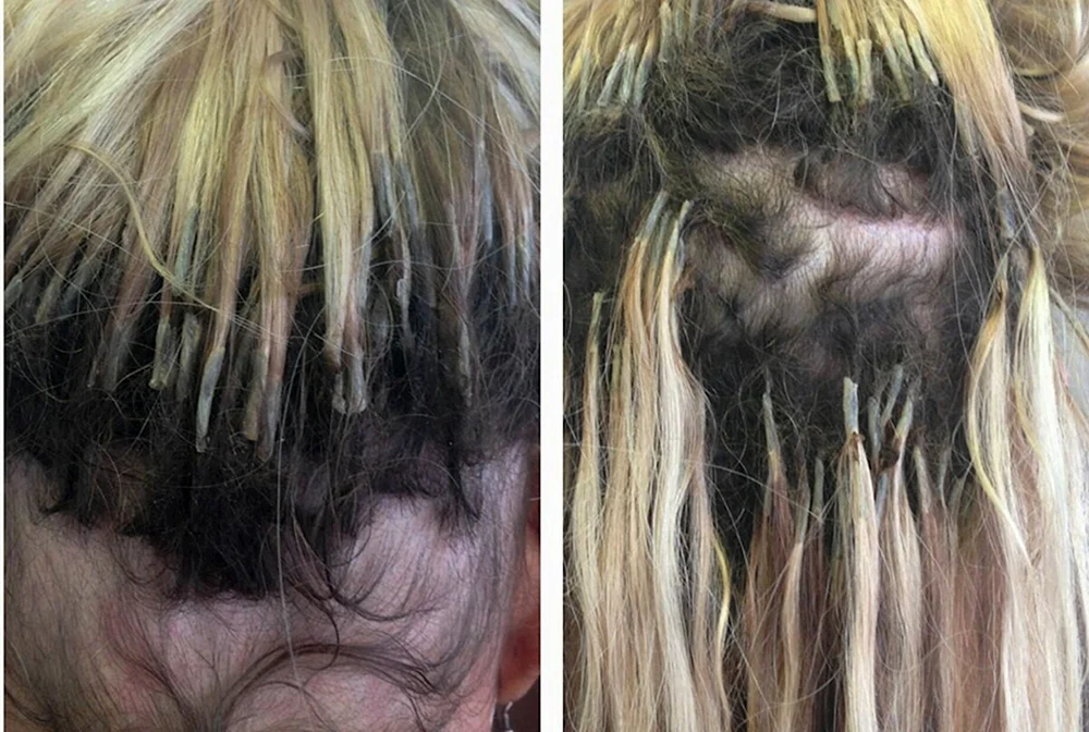 Kapseln Wachsendes Haar