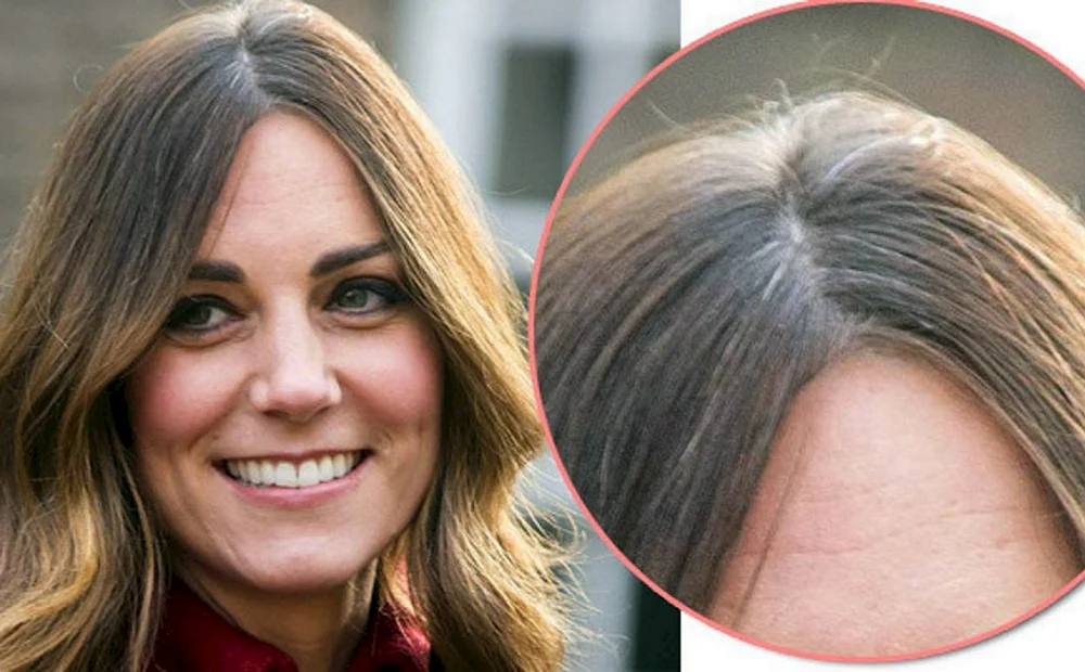 Kate Middleton graues Haar