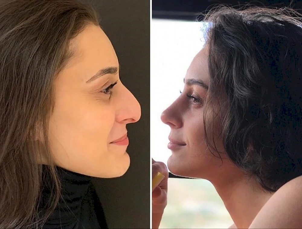 Gal Gadot Nase mit Höcker