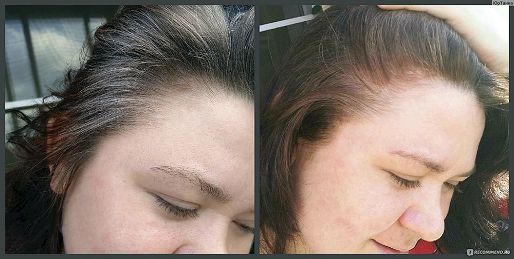 Henna zum Färben grauer Haare