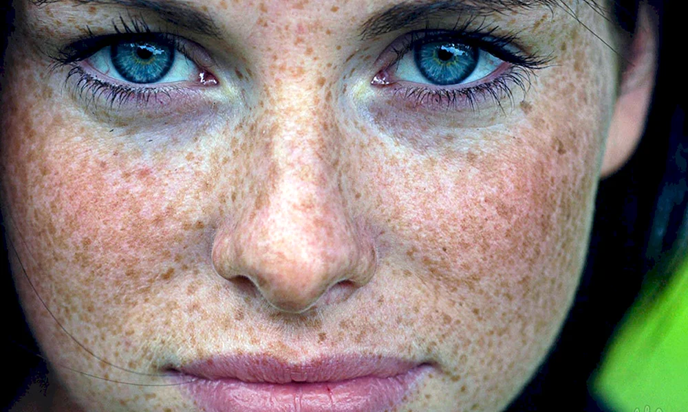 Claire Foy Sommersprossen