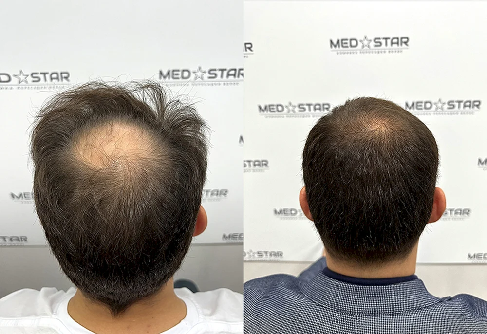 Haartransplantationsklinik