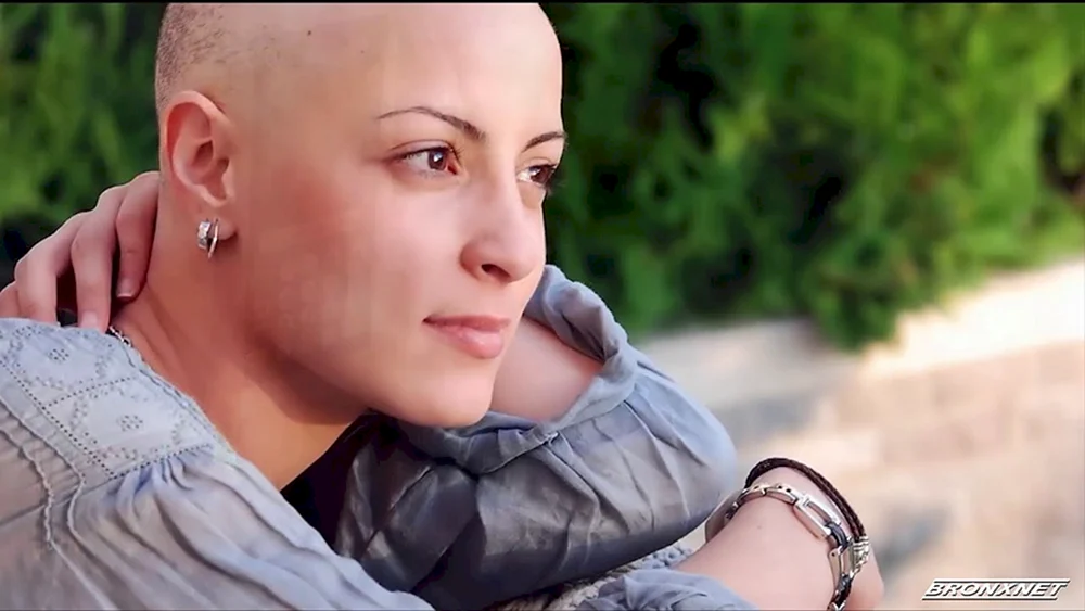 Kurzhaarschnitte für Frauen mit Chemotherapie