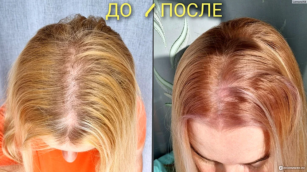 Garnier 8.0