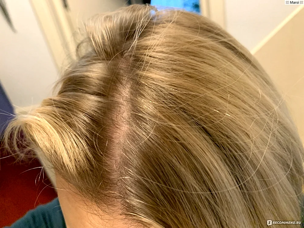 Pearl blonde 2023