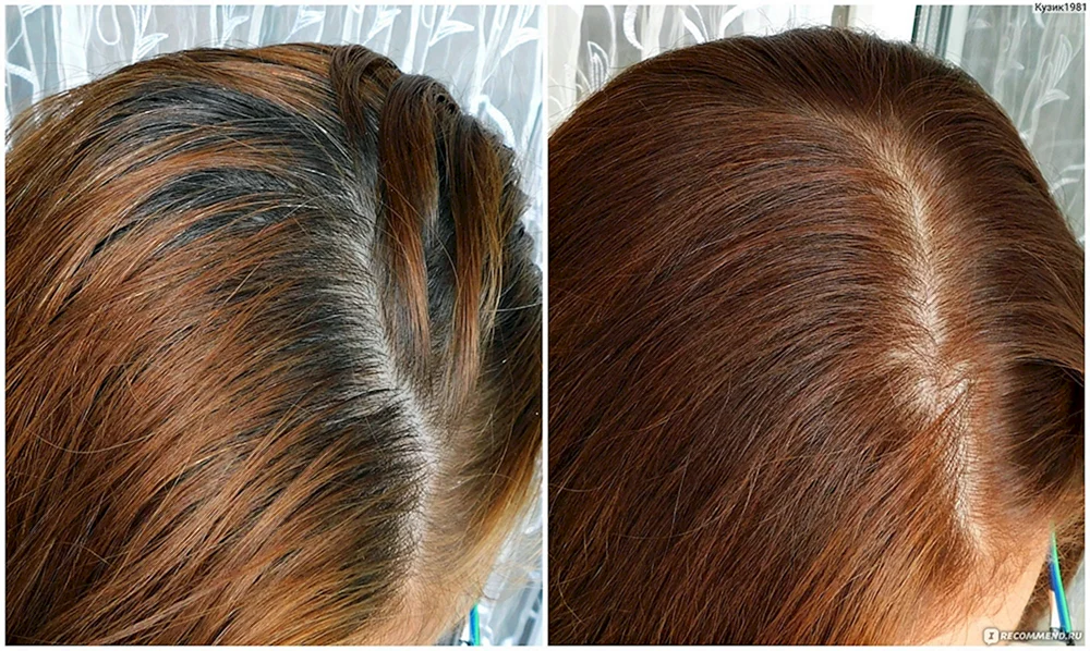 Loreal 780