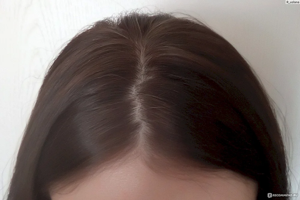 Loreal 613 Frostglasur