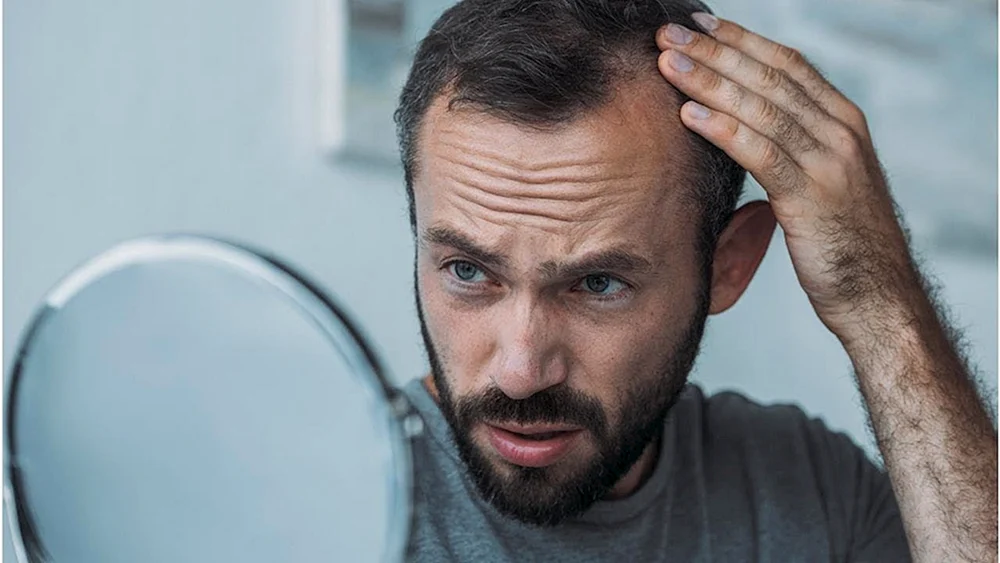 Frisuren mit Stirnglatze bei Männern