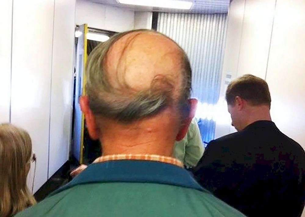 Kahlfrisuren