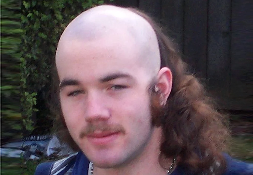 Lange Glatze mit langen Haaren