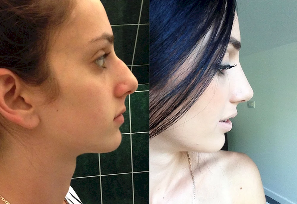 Maria Valverde Höckernase im Profil