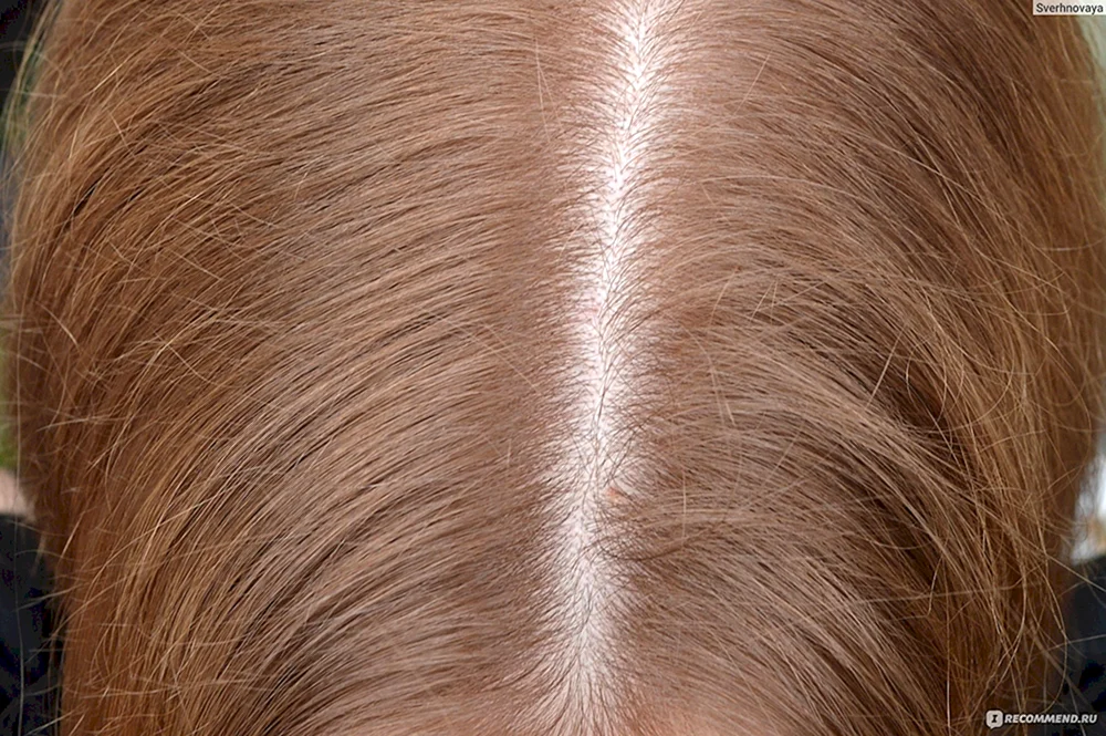 Loreal Honigblond Haarfarbe
