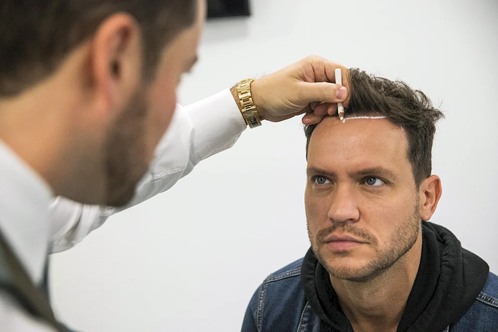Männerfrisuren mit Glatze