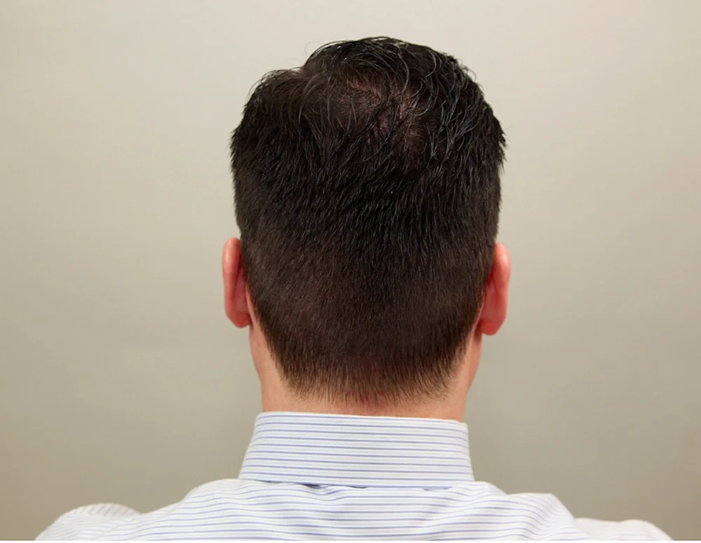 Mohawk-Haarschnitt