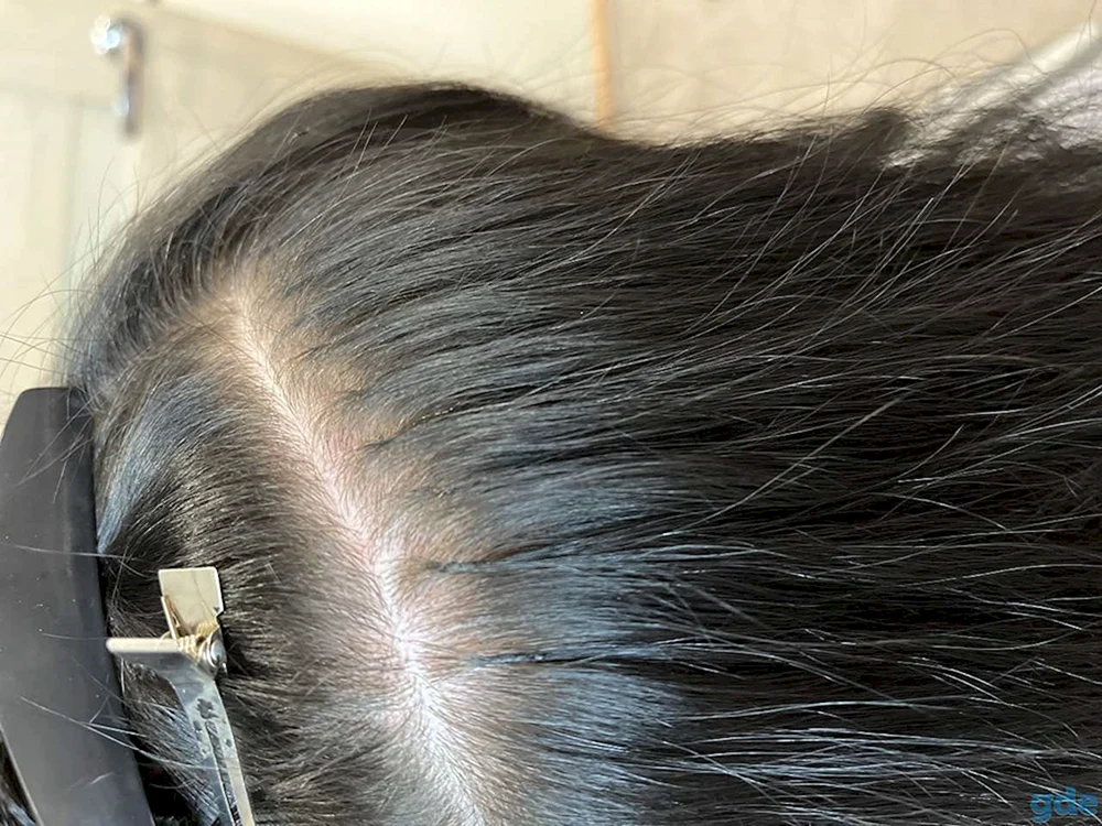 Nano-Kapsel-Haarverlängerungen