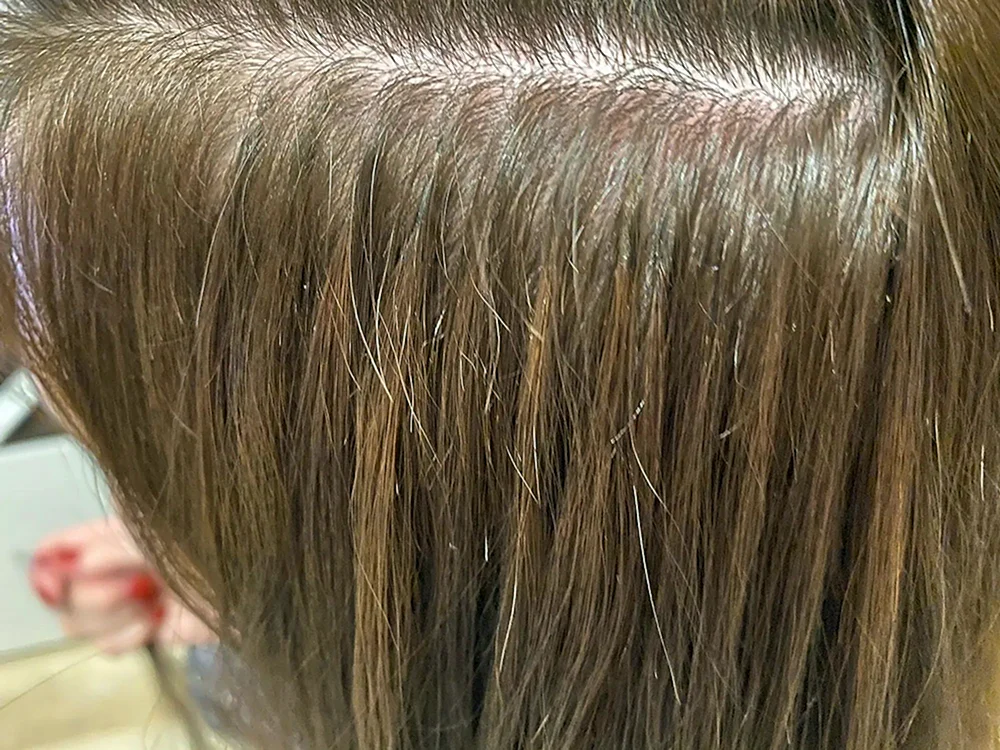 Nano-Kapsel-Haarverlängerungen